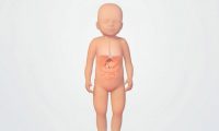 小儿胃底折叠术治疗胃食管反流病：三维医疗动画制作